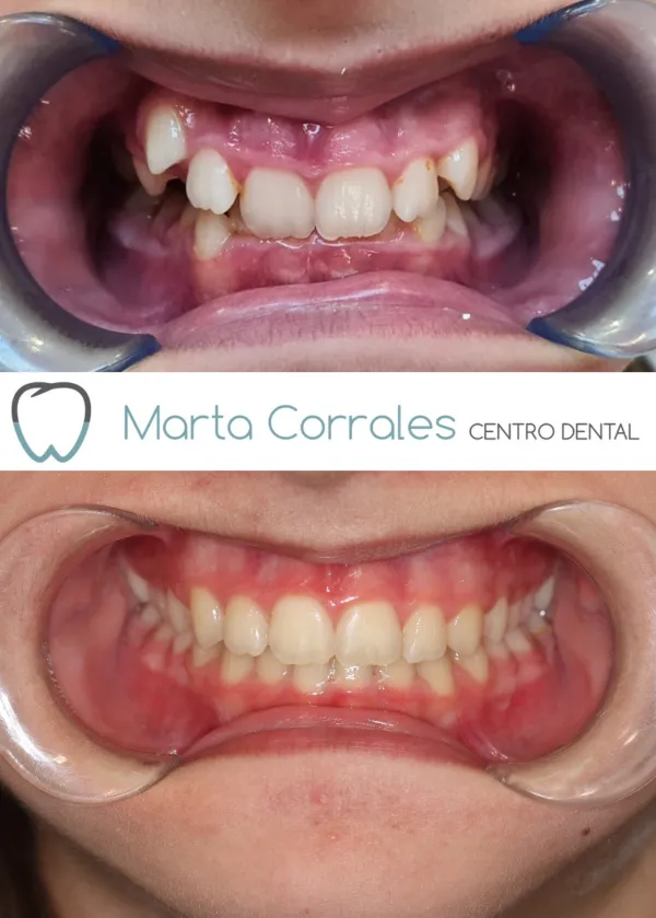 ortodoncia Ronda - Clínica dental Marta Corrales
