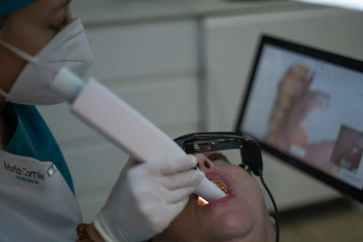 Sonrisa perfecta y blanca conseguida con estética dental en Ronda