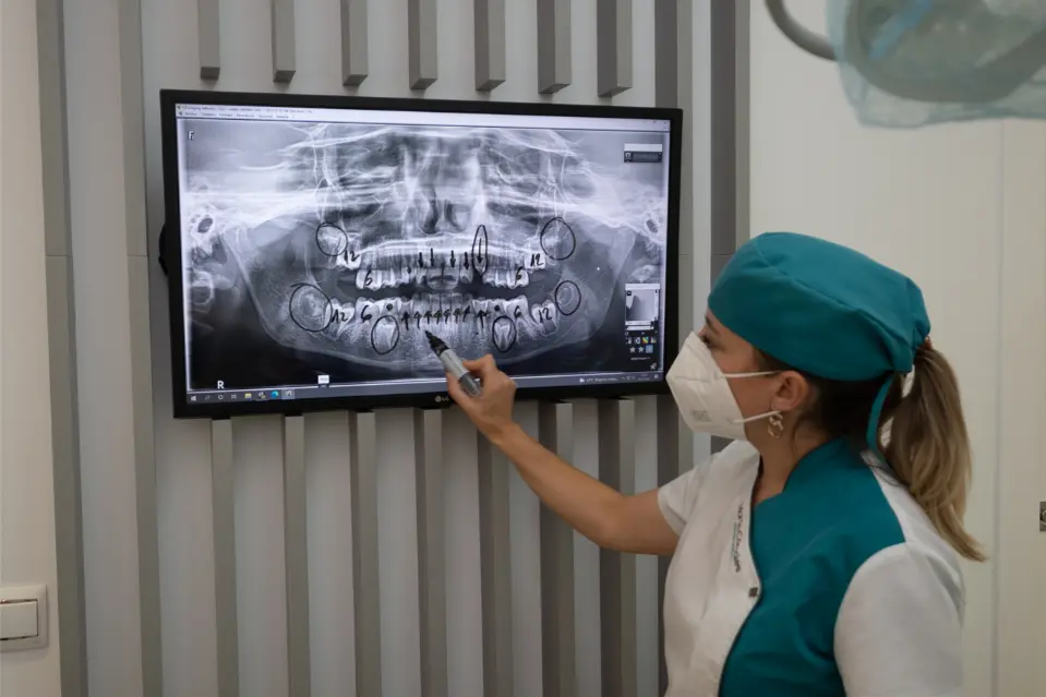 Odontología Conservadora Ronda